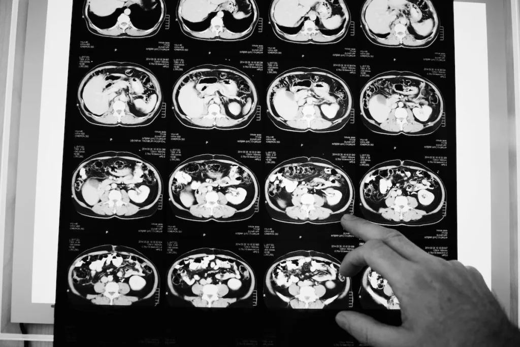 mri of human brain