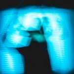 AI w ultrasonografii wewnątrznaczyniowej serca